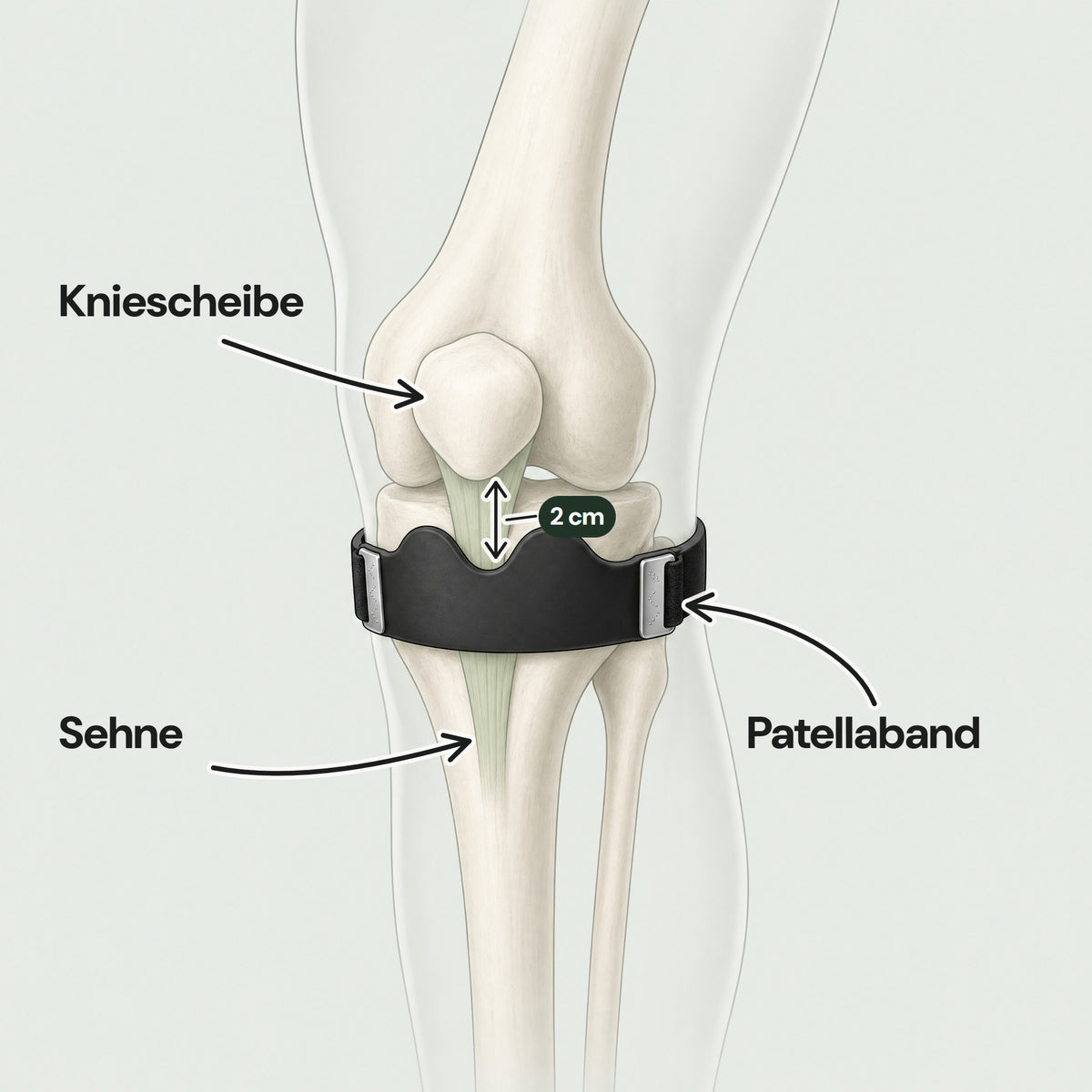 Kniescheibe, Sehne und Patellaband: Das Band sitzt direkt unter der Kniescheibe